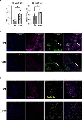 Gut epithelial barrier dysfunction in lupus triggers a differential humoral response against gut commensals